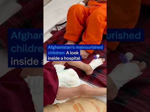 Afghanistan’s malnourished children: A look inside a hospital | DW News